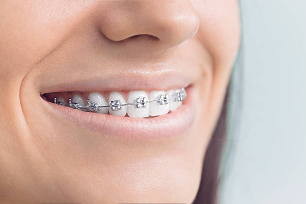 Why Choose Us for Your Dental Needs in North Salt Lake, UT